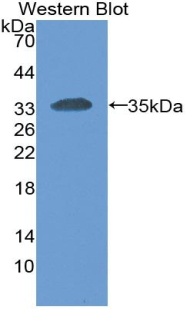 Monoclonal Antibody to Carcinoembryonic Antigen Related Cell Adhesion Molecule 1 (CEACAM1)