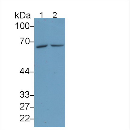 Monoclonal Antibody to Arginyl tRNA Synthetase (RARS)