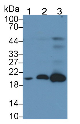 Monoclonal Antibody to Ferritin, Light Polypeptide (FTL)