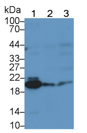 Monoclonal Antibody to Ferritin, Light Polypeptide (FTL)