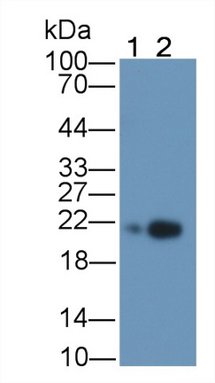 Monoclonal Antibody to Ferritin, Light Polypeptide (FTL)