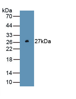 Monoclonal Antibody to Ferritin, Heavy Polypeptide (FTH)