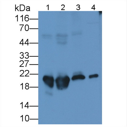 Monoclonal Antibody to Ferritin, Heavy Polypeptide (FTH)