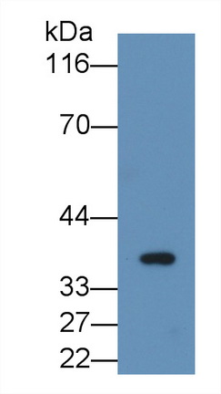 Monoclonal Antibody to Fibrinogen Like Protein 1 (FGL1)