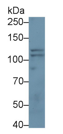 Monoclonal Antibody to Neuropilin 2 (NRP2)