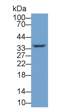 Monoclonal Antibody to Carbonic Anhydrase IV (CA4)