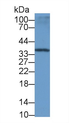 Monoclonal Antibody to Carbonic Anhydrase IV (CA4)