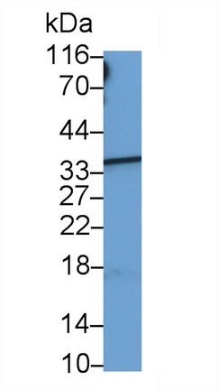 Monoclonal Antibody to Hemoglobin Beta (HBb)