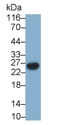 Monoclonal Antibody to T-Cell Surface Glycoprotein CD3 Gamma (CD3g)