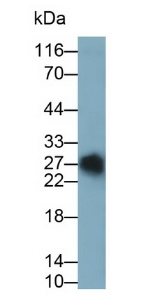 Monoclonal Antibody to T-Cell Surface Glycoprotein CD3 Gamma (CD3g)