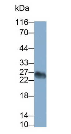 Monoclonal Antibody to T-Cell Surface Glycoprotein CD3 Gamma (CD3g)