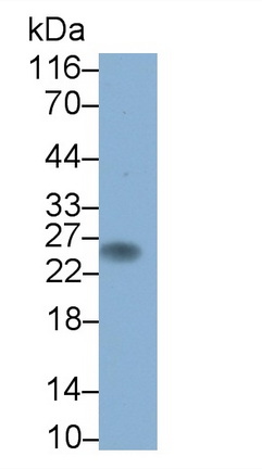 Monoclonal Antibody to T-Cell Surface Glycoprotein CD3 Gamma (CD3g)
