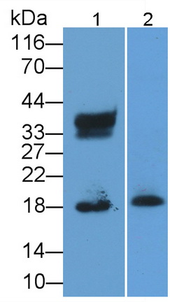 Monoclonal Antibody to Ribonuclease A2 (RNASE2)