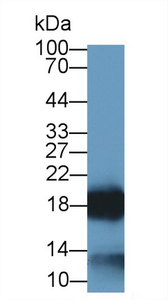 Monoclonal Antibody to Ribonuclease A2 (RNASE2)