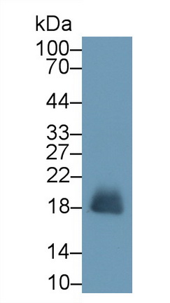 Monoclonal Antibody to Ribonuclease A2 (RNASE2)