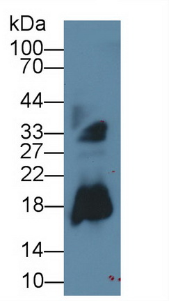 Monoclonal Antibody to Ribonuclease A2 (RNASE2)