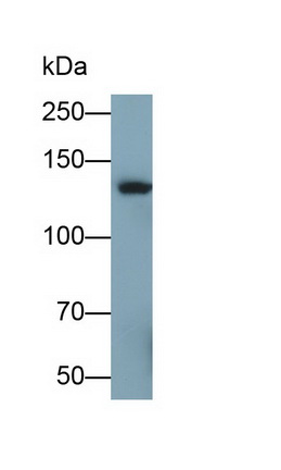 Monoclonal Antibody to Sucrase Isomaltase (SI)