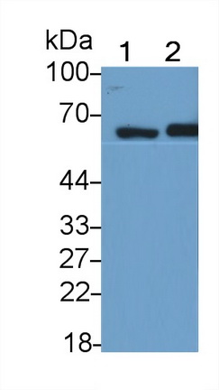 Monoclonal Antibody to Sequestosome 1 (SQSTM1)