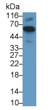 Monoclonal Antibody to Sequestosome 1 (SQSTM1)