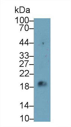 Monoclonal Antibody to Chorionic Gonadotropin Beta Polypeptide (CGb)