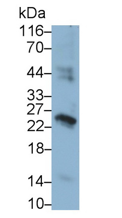 Monoclonal Antibody to Chorionic Gonadotropin Beta Polypeptide (CGb)