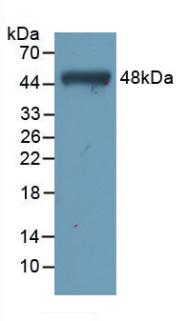 Monoclonal Antibody to Troponin C Type 1, Slow (TNNC1)