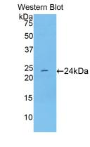 Monoclonal Antibody to Troponin I Type 1, Slow Skeletal (TNNI1)