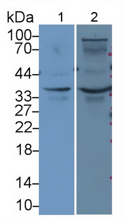 Monoclonal Antibody to Troponin T Type 2, Cardiac (TNNT2)