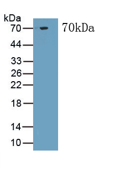 Monoclonal Antibody to Troponin T Type 2, Cardiac (TNNT2)