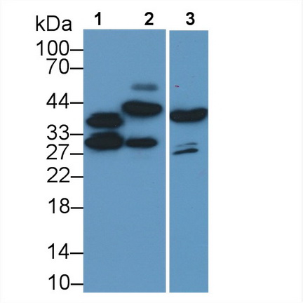 Monoclonal Antibody to Troponin T Type 2, Cardiac (TNNT2)