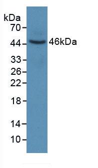 Monoclonal Antibody to Keratin 6A (KRT6A)