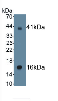 Monoclonal Antibody to Amiloride Sensitive Sodium Channel Subunit Gamma (SCNN1g)