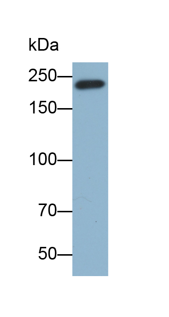 Monoclonal Antibody to Myosin Heavy Chain 7, Cardiac Muscle, Beta (MYH7)