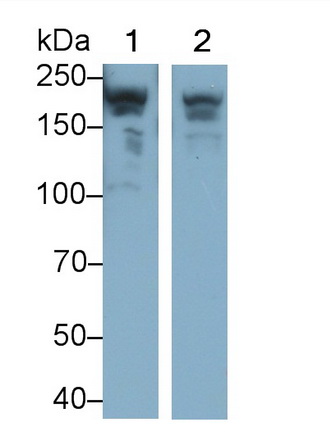 Monoclonal Antibody to Myosin Heavy Chain 7, Cardiac Muscle, Beta (MYH7)