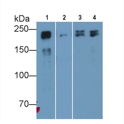 Monoclonal Antibody to Myosin Heavy Chain 8, Skeletal Muscle, Perinatal (MYH8)