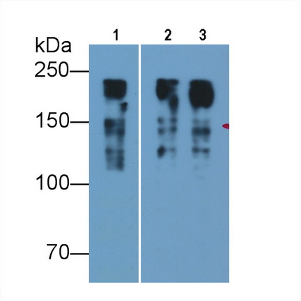 Monoclonal Antibody to Myosin Heavy Chain 8, Skeletal Muscle, Perinatal (MYH8)