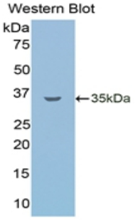 Monoclonal Antibody to Lipolysis Stimulated Lipoprotein Receptor (LSR)