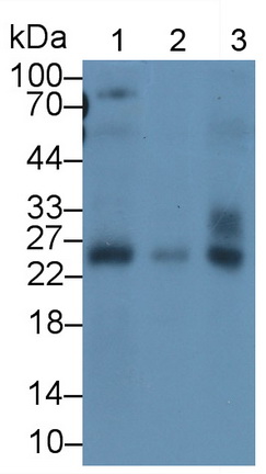 Monoclonal Antibody to Deoxythymidylate Kinase (DTYMK)