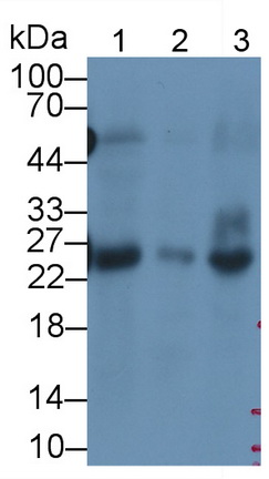 Monoclonal Antibody to Deoxythymidylate Kinase (DTYMK)