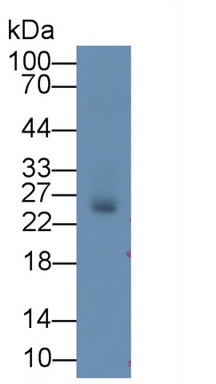 Monoclonal Antibody to Deoxythymidylate Kinase (DTYMK)