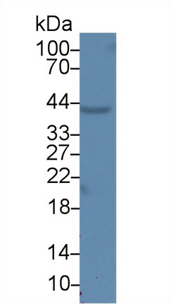 Monoclonal Antibody to Arginase II (Arg2)