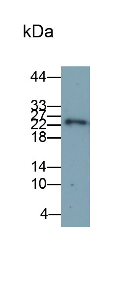 Monoclonal Antibody to Acidic Salivary Proline Rich Phosphoprotein 2 (PRH2)