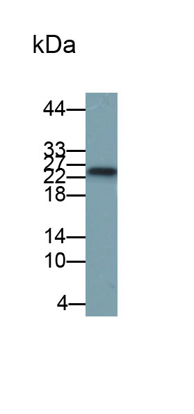 Monoclonal Antibody to Acidic Salivary Proline Rich Phosphoprotein 2 (PRH2)