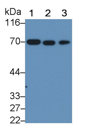 Monoclonal Antibody to Neurofilament, Light Polypeptide (NEFL)