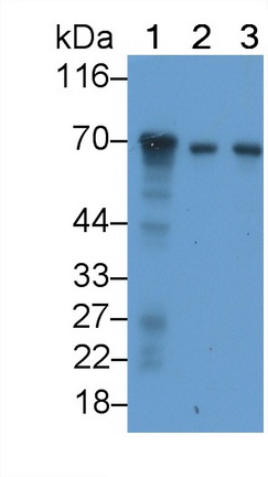 Monoclonal Antibody to Neurofilament, Light Polypeptide (NEFL)