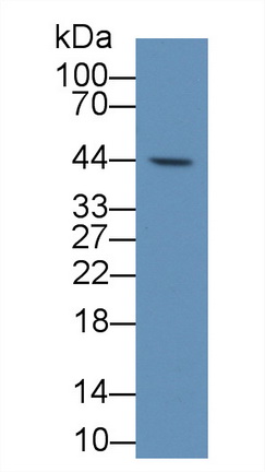 Monoclonal Antibody to Tryptophan-2,3-dioxygenase (TDO)