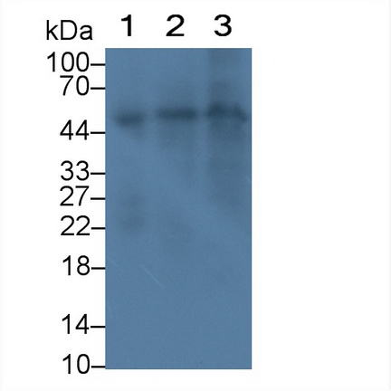 Monoclonal Antibody to Folate Transporter (FOLT)