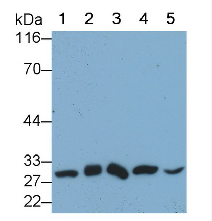 Monoclonal Antibody to Phosphoglycerate Mutase 1, Brain (PGAM1)