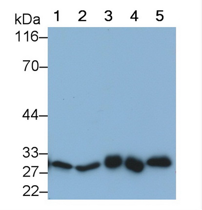 Monoclonal Antibody to Phosphoglycerate Mutase 1, Brain (PGAM1)