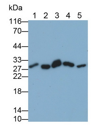 Monoclonal Antibody to Phosphoglycerate Mutase 1, Brain (PGAM1)